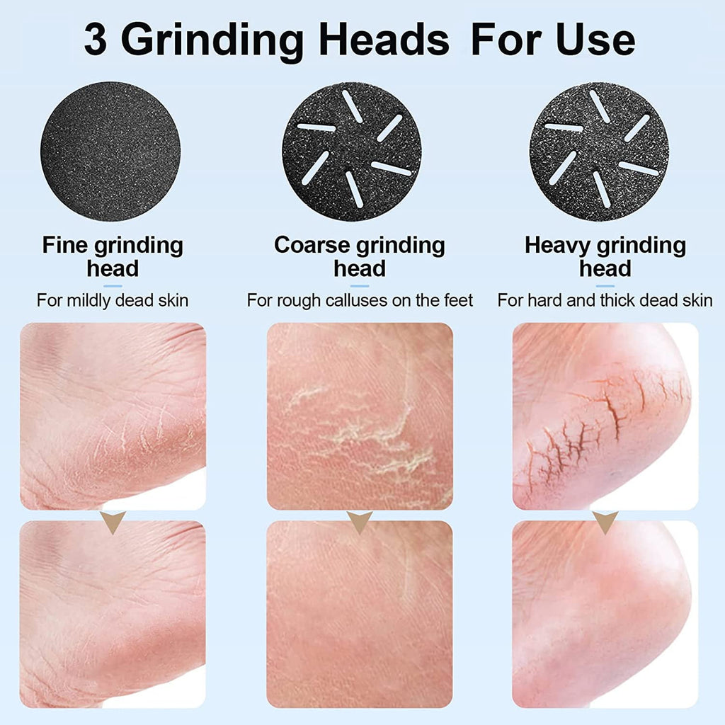 Prociv Electric Foot Callus Remover with Vacuum Cleaner Rechargeable Foot File Dead Skin Remover with 2 Speed 3 Grinding Head LCD Display Professional Kit for Foot Care Black